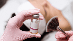 Chemical Peels