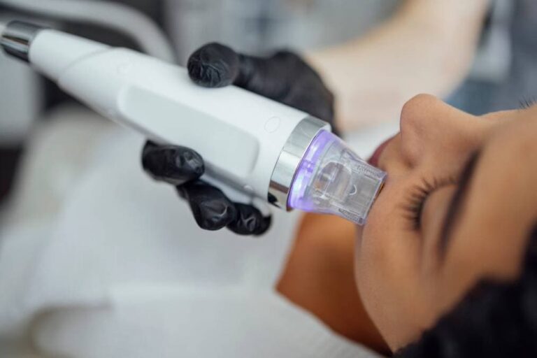 RF Microneedling in Rye NY