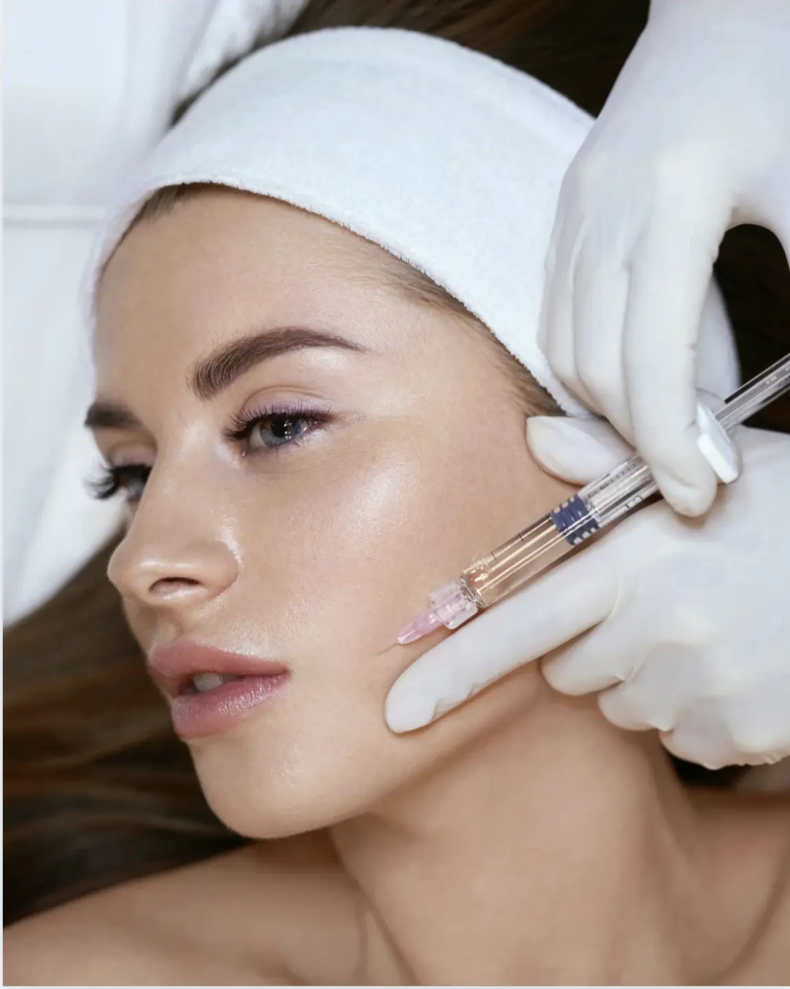 Bio-fillers treatment in cheek