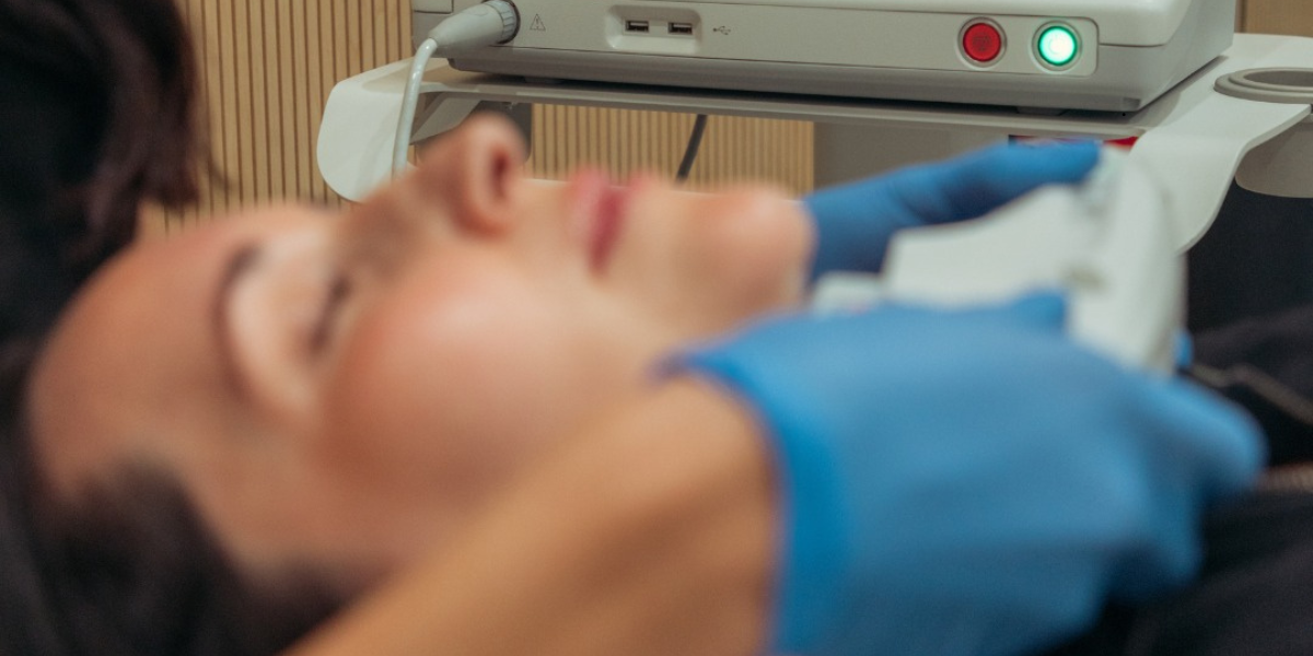 Your Ultherapy Results Timeline