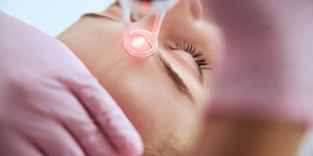 How Do Traditional CO2 and CoolPeel Work