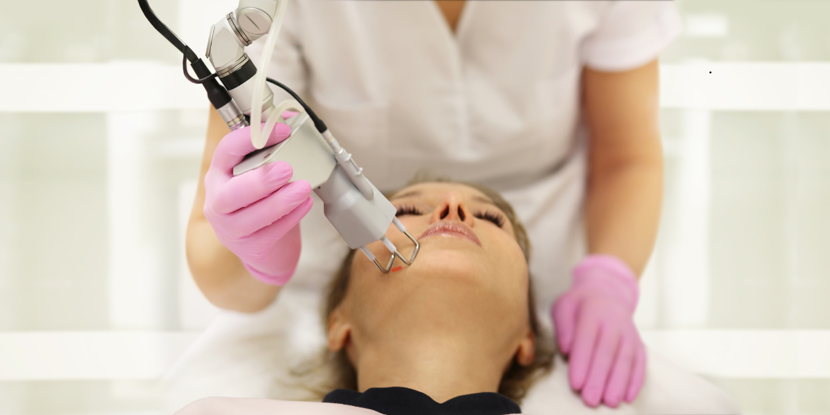 Pros and Cons Traditional CO2 vs. CoolPeel