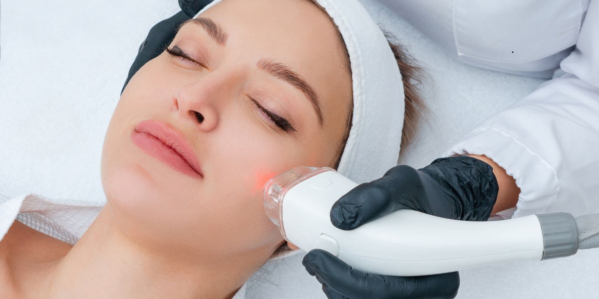 Traditional CO2 Laser vs. CoolPeel: Which Resurfacing Treatment Is Right for You?