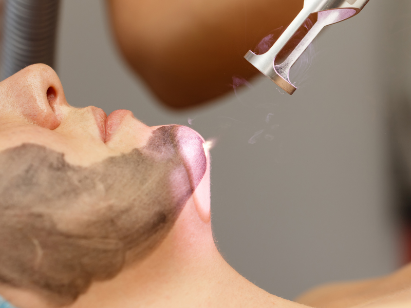 Your complete day-by-day CO2 laser recovery timeline