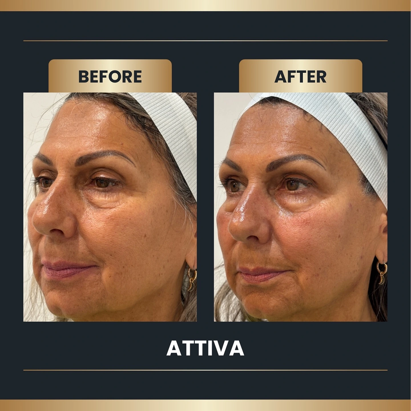Attiva result