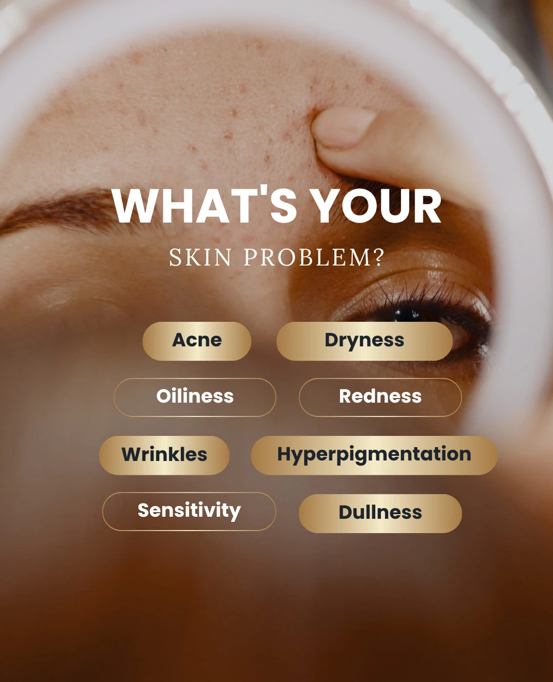 PRX Perfexion Peel 1