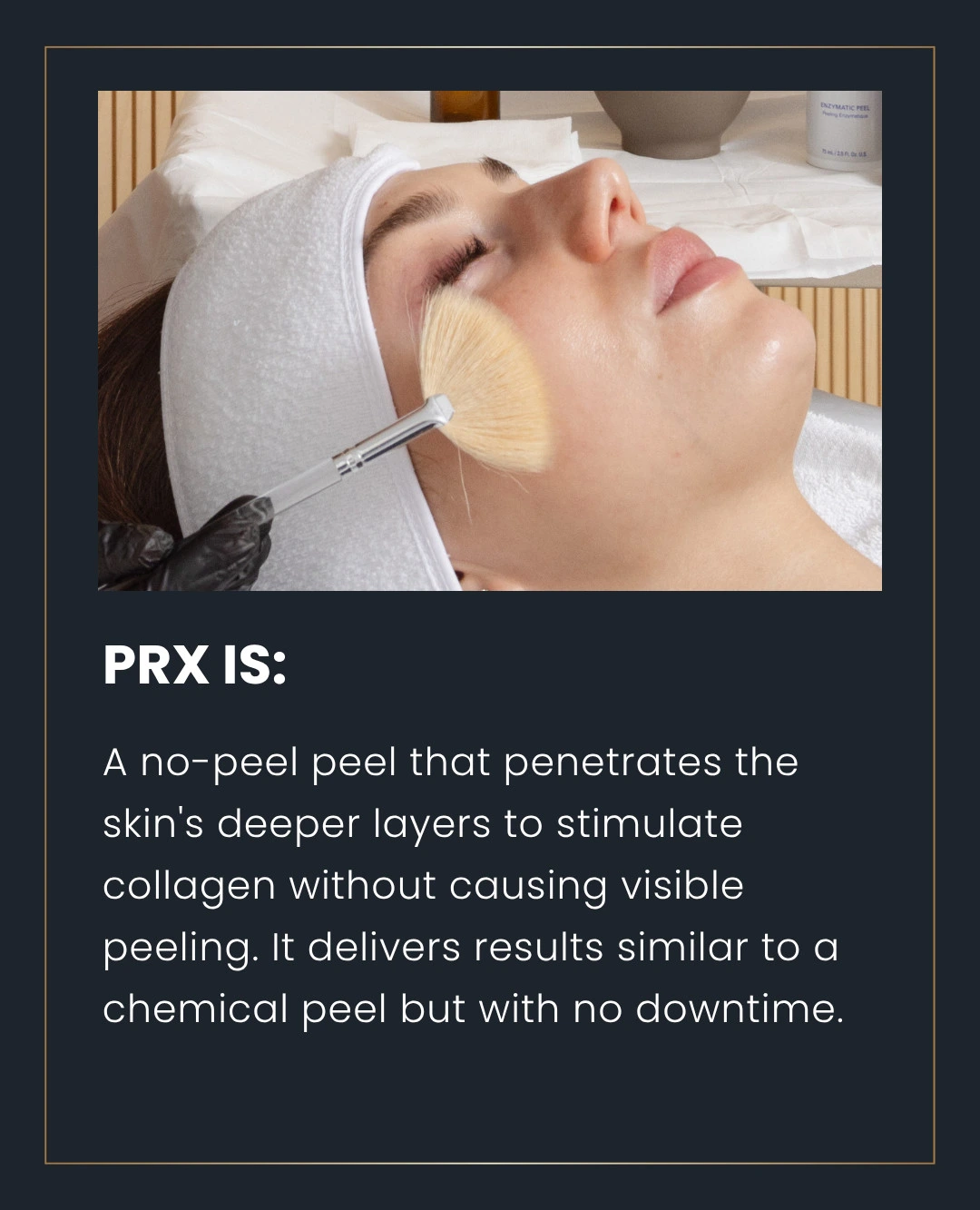 PRX Perfexion Peel 2