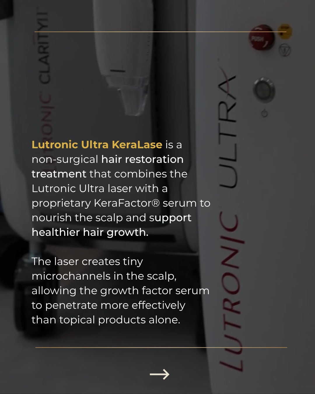 Lutronic Ultra™ with KeraLase™