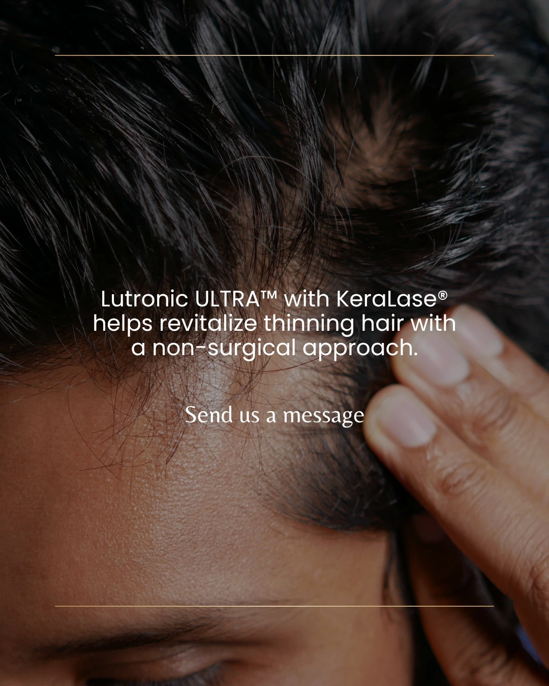 hair restoration with keralase