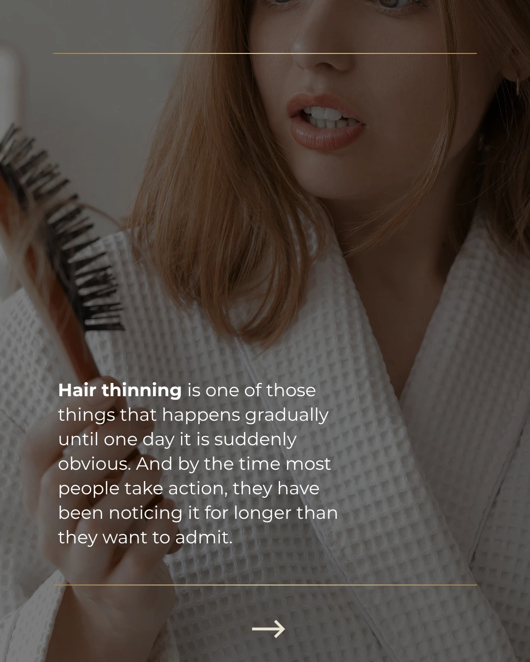 hair thinning